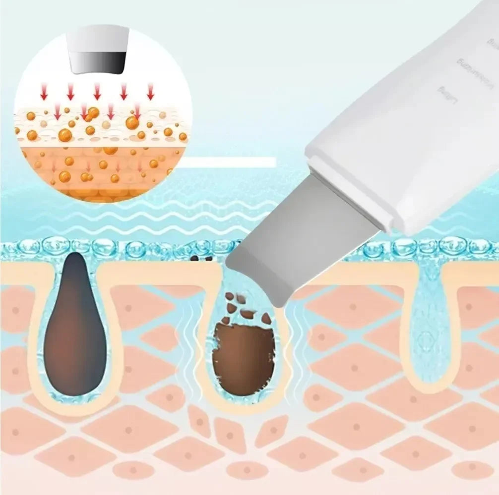 UltraSkin™ – Tecnología ultrasónica para tu piel